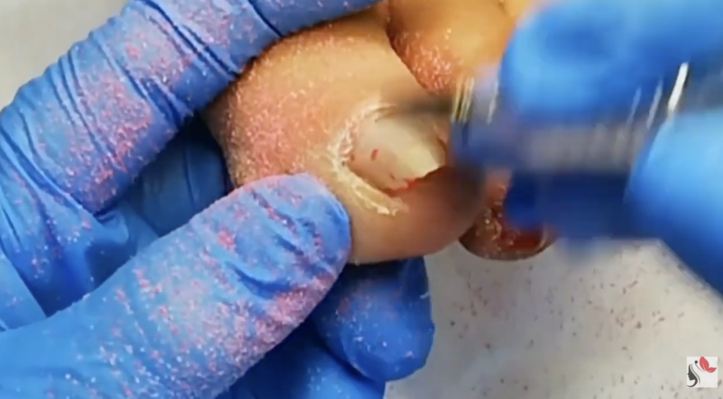 Pedicure con Semipermanente: Guida Step by Step